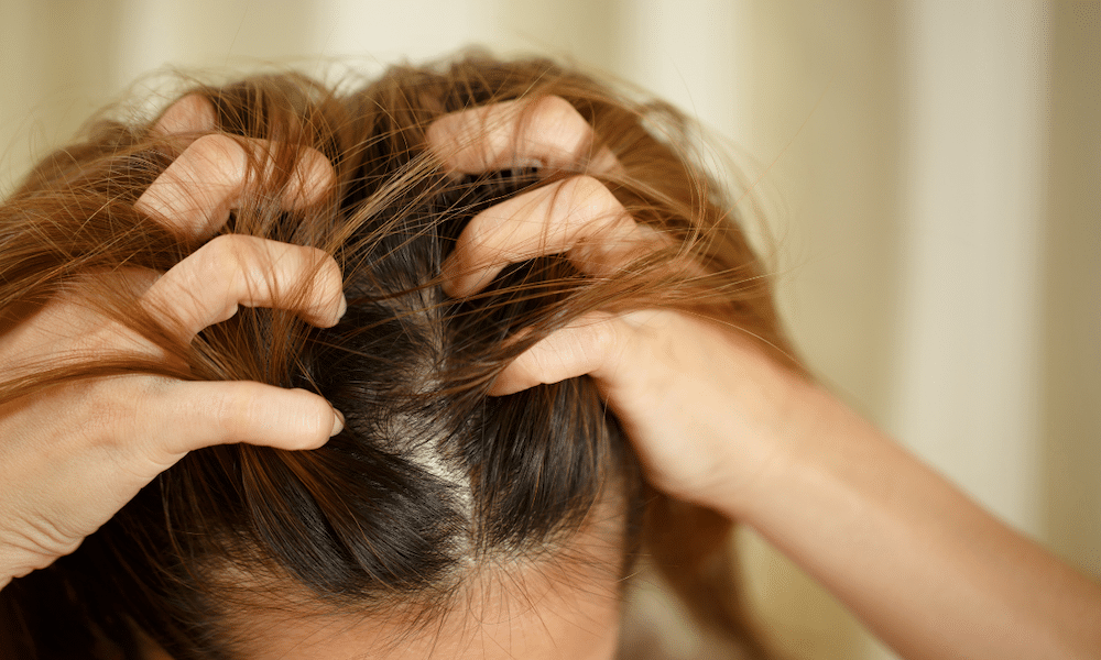 Lire la suite à propos de l’article Pellicules cheveux bouclés : Quelles sont les causes ?